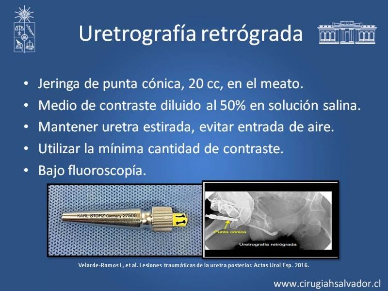 Diapositiva 17 de Trauma Uretral