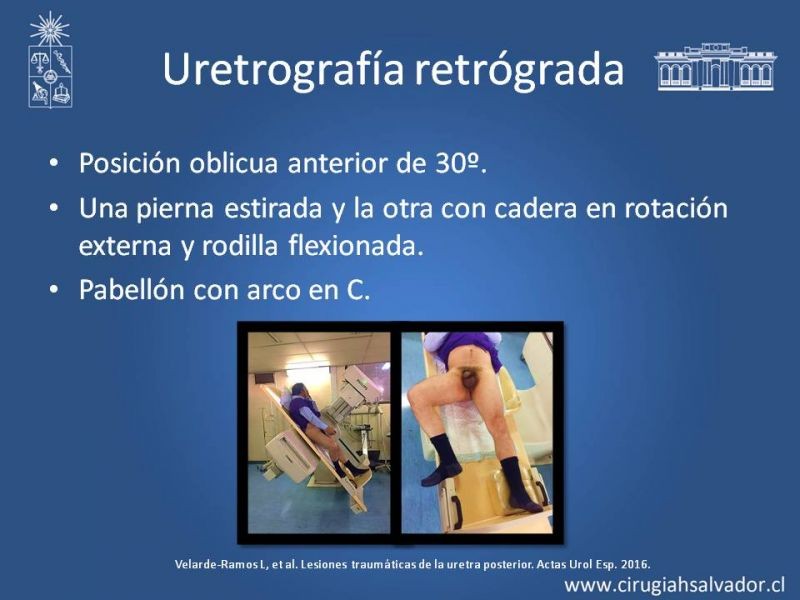 Diapositiva 16 de Trauma Uretral