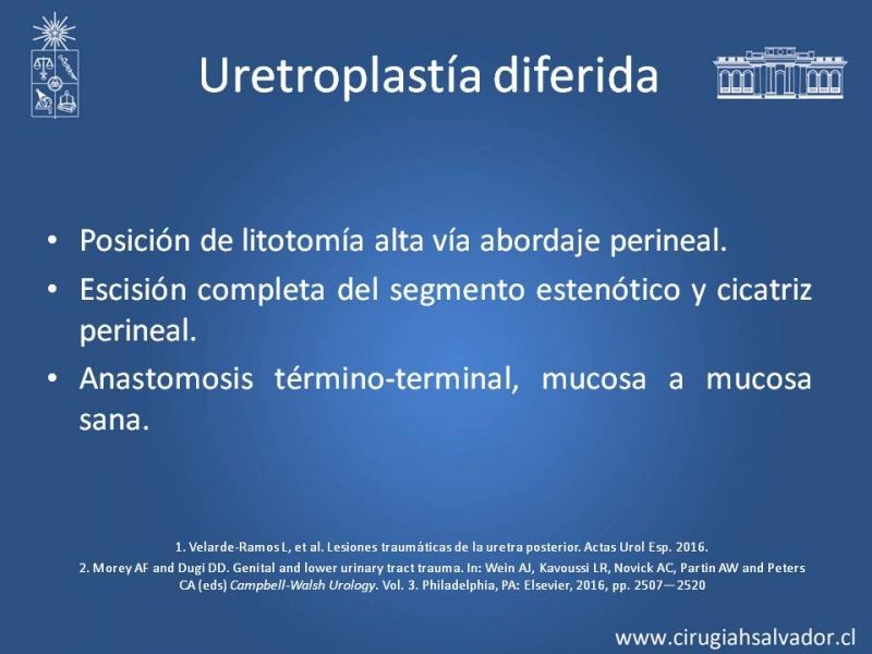 Diapositiva 32 de Trauma Uretral