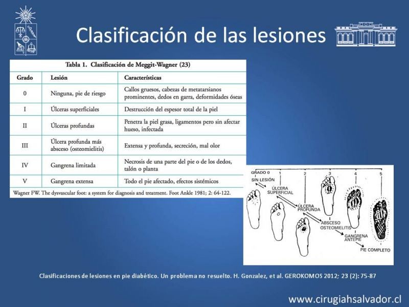 Diapositiva 12 de Pie Diabético