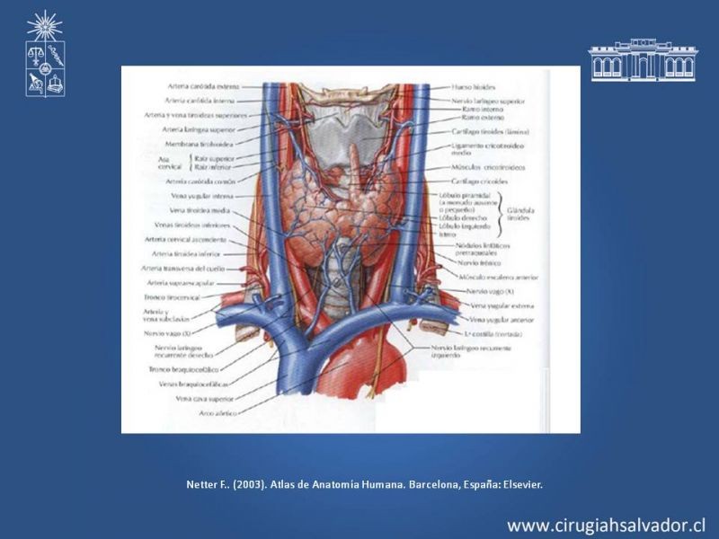 Diapositiva 2 de Hematoma Cervical