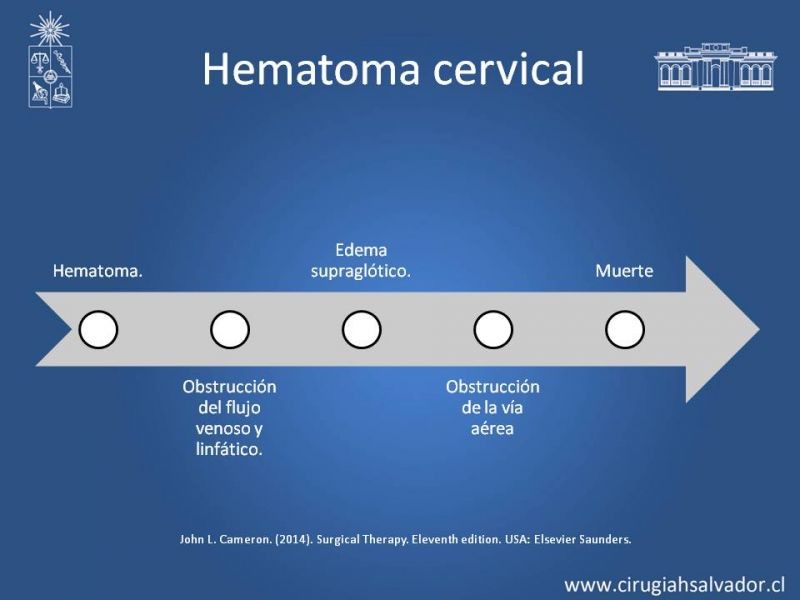 Diapositiva 12 de Hematoma Cervical