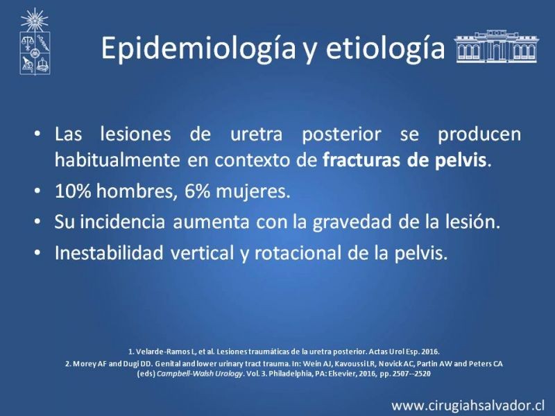 Diapositiva 6 de Trauma Uretral