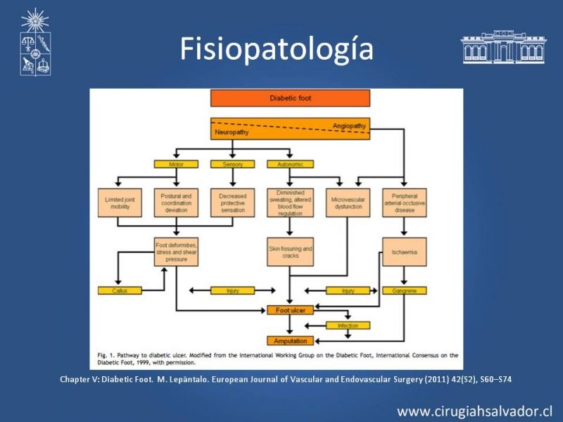 Diapositiva 7 de Pie Diabético