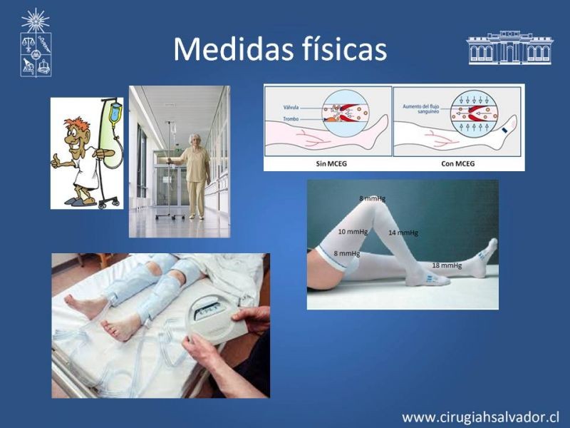 Diapositiva 14 de Prevención Enfermedad Tromboembólica