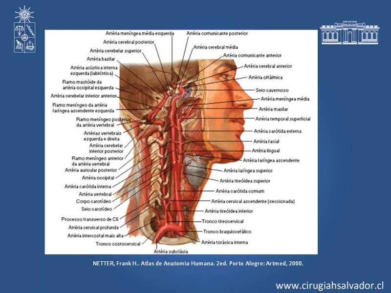 Diapositiva 1 de Hematoma Cervical