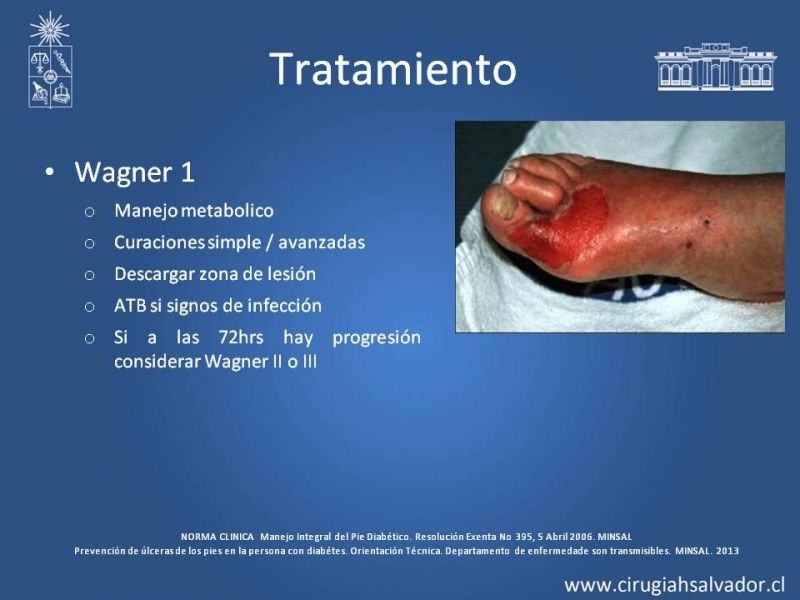 Diapositiva 19 de Pie Diabético