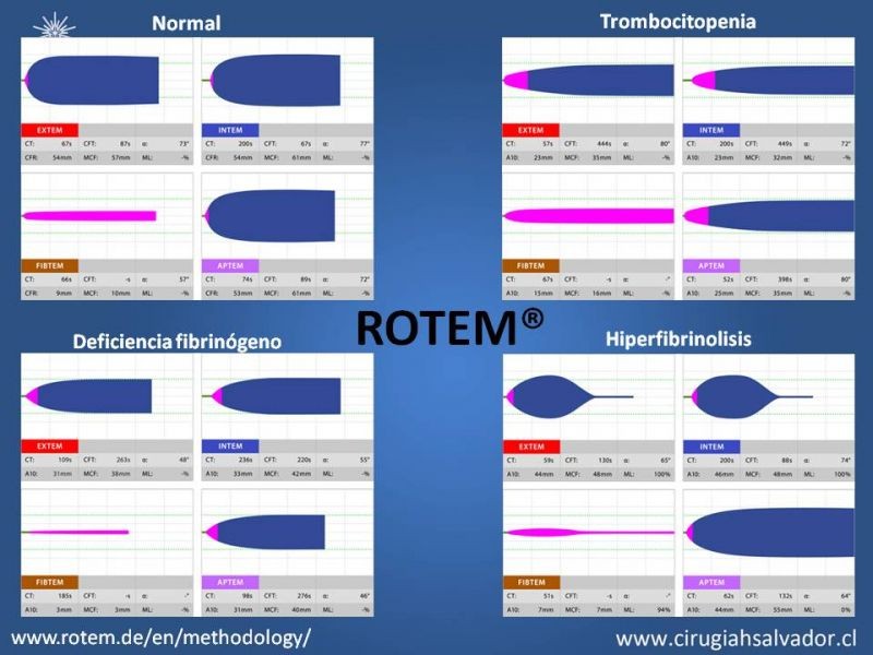 Diapositiva 14 de Terapia transfusional en trauma