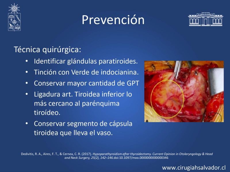 Diapositiva 12 de Hipocalcemia post cirugía tiroidea 