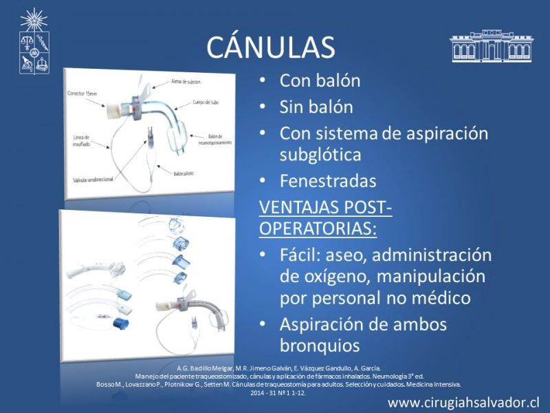 Diapositiva 16 de Traqueostomía