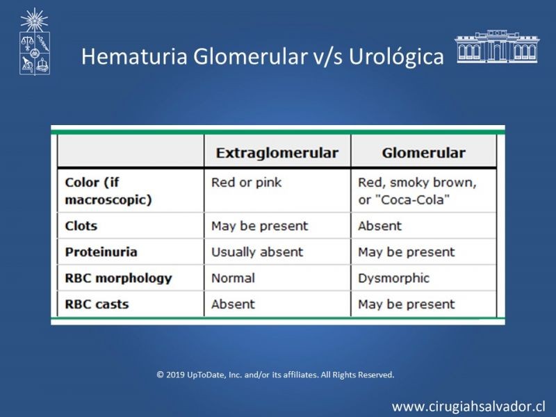 Diapositiva 12 de Hematuria: Hematuria-Urológica-Urgencias
