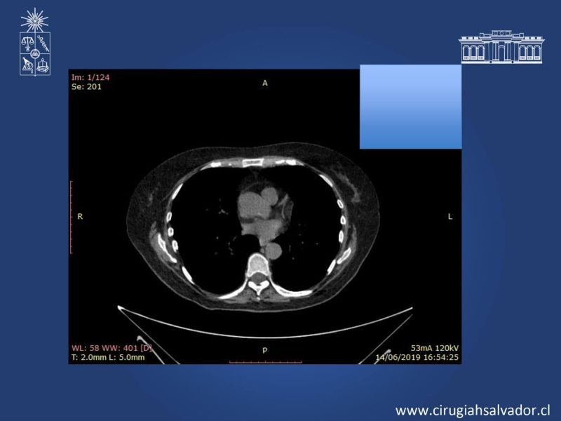 Diapositiva 7 de Caso Clínico 