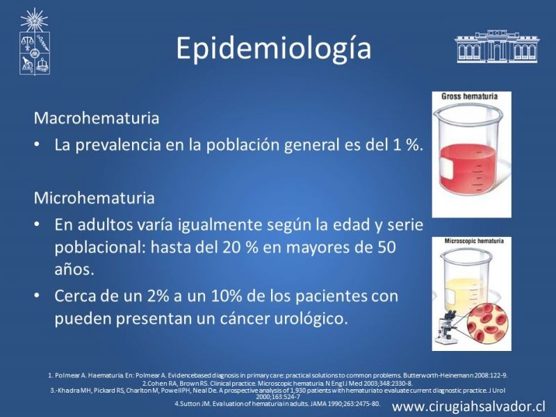 Diapositiva 3 de Hematuria: Hematuria-Urológica-Urgencias