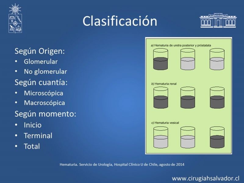 Diapositiva 5 de Hematuria: Hematuria-Urológica-Urgencias