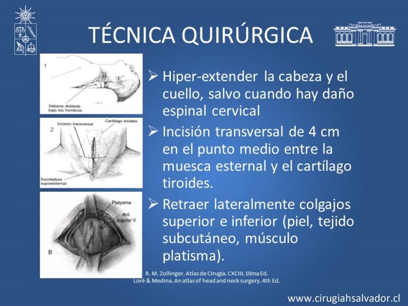Diapositiva 10 de Traqueostomía