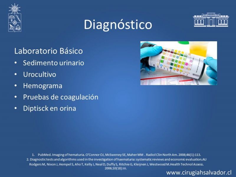 Diapositiva 11 de Hematuria: Hematuria-Urológica-Urgencias