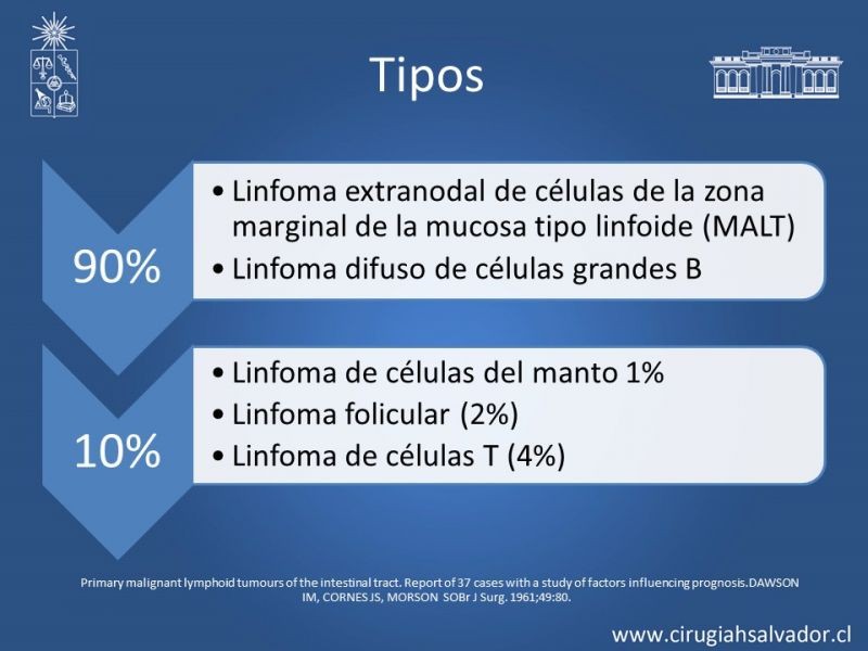 Diapositiva 17 de Caso Clínico: Linfoma Gástrico