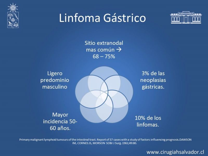 Diapositiva 13 de Caso Clínico: Linfoma Gástrico