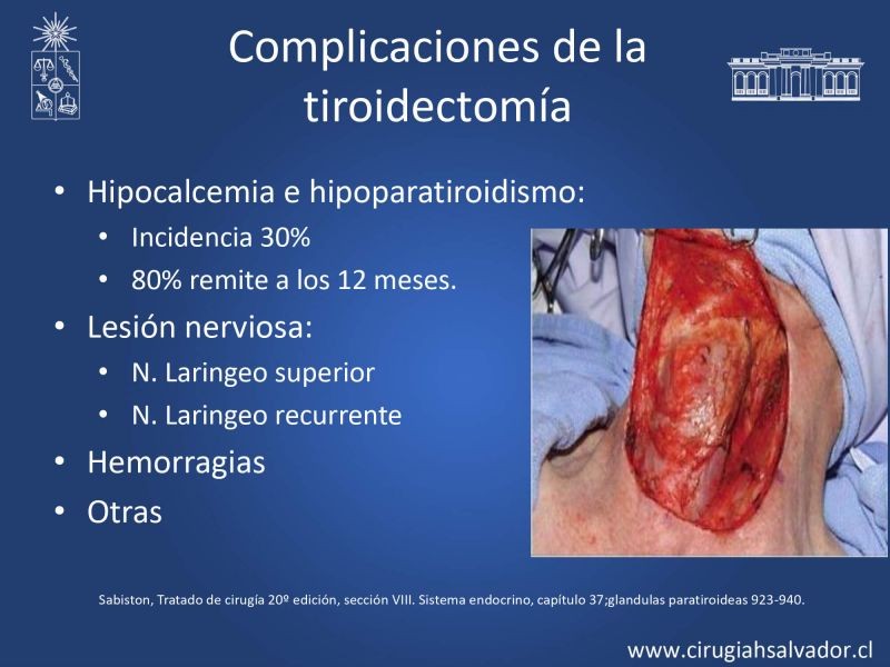 Diapositiva 7 de Hipocalcemia post cirugía tiroidea 