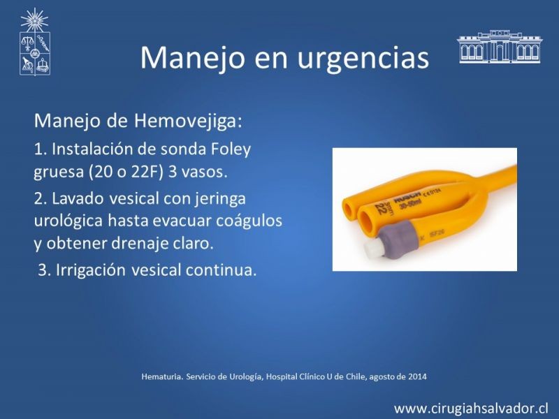 Diapositiva 18 de Hematuria: Hematuria-Urológica-Urgencias