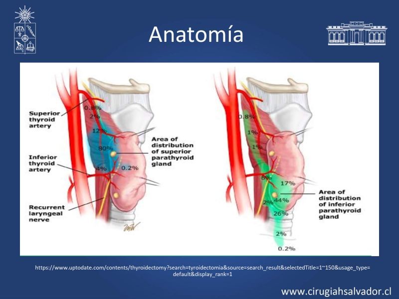 Diapositiva 8 de Hipocalcemia post cirugía tiroidea 