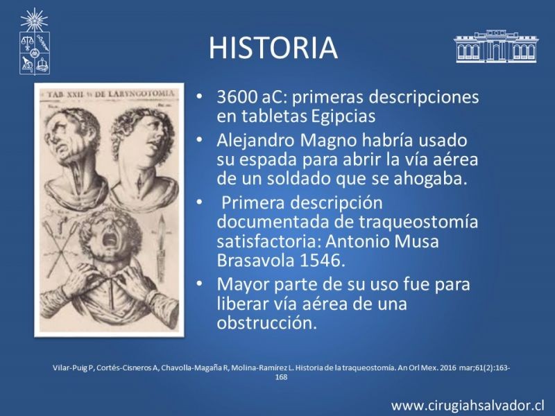 Diapositiva 2 de Traqueostomía