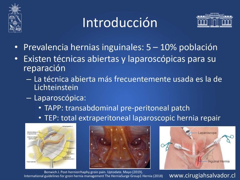Diapositiva 2 de Inguinodinia post hernioplastía inguinal