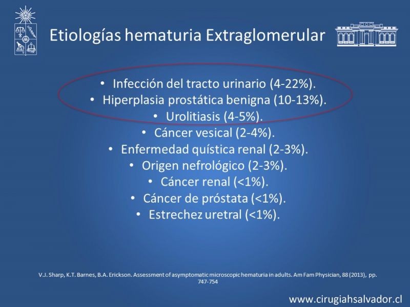 Diapositiva 7 de Hematuria: Hematuria-Urológica-Urgencias