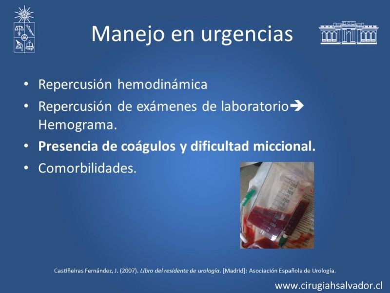 Diapositiva 17 de Hematuria: Hematuria-Urológica-Urgencias
