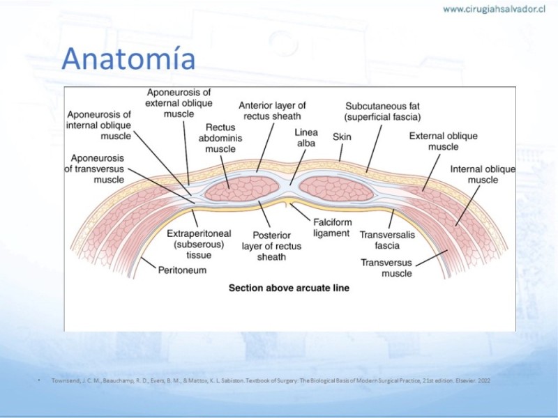 Diapositiva 7 de Posición de malla en hernias: Onlay, Inley, Subley