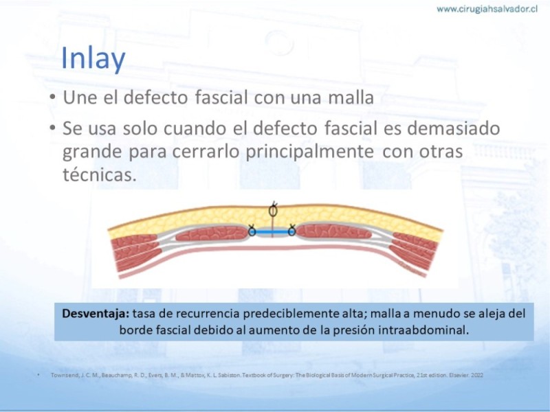 Diapositiva 18 de Posición de malla en hernias: Onlay, Inley, Subley