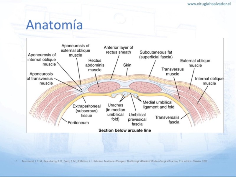 Diapositiva 8 de Posición de malla en hernias: Onlay, Inley, Subley