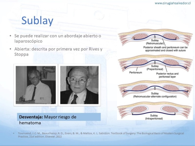 Diapositiva 12 de Posición de malla en hernias: Onlay, Inley, Subley