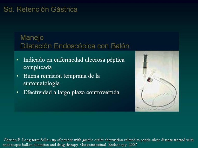 Diapositiva 20 de Síndrome Retención Gástrica
