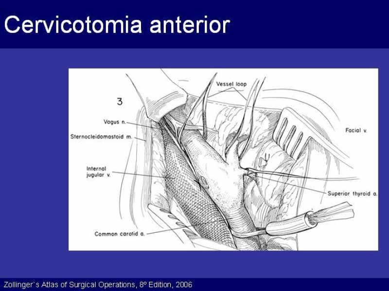 Diapositiva 42 de Trauma Cervical Penetrante