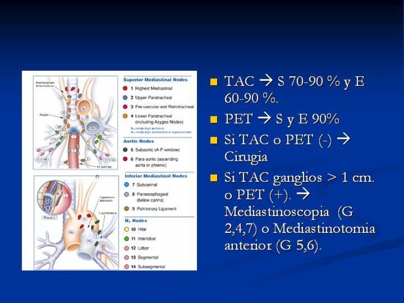 Diapositiva 5 de Tratamiento Cáncer Pulmonar Células no Pequeñas