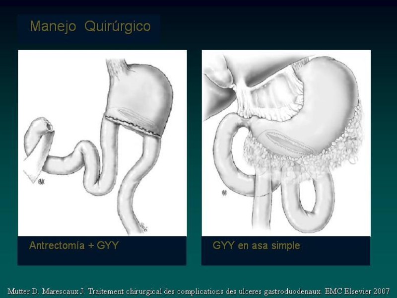 Diapositiva 29 de Síndrome Retención Gástrica