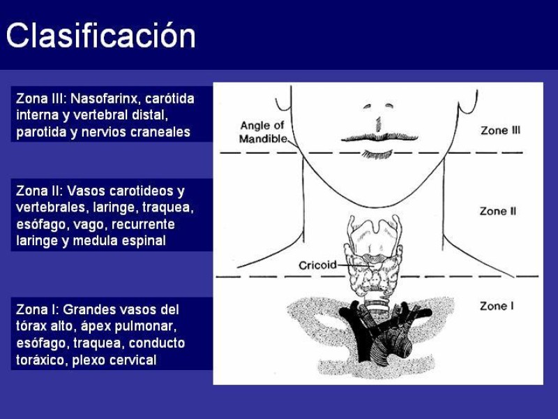 Diapositiva 3 de Trauma Cervical Penetrante