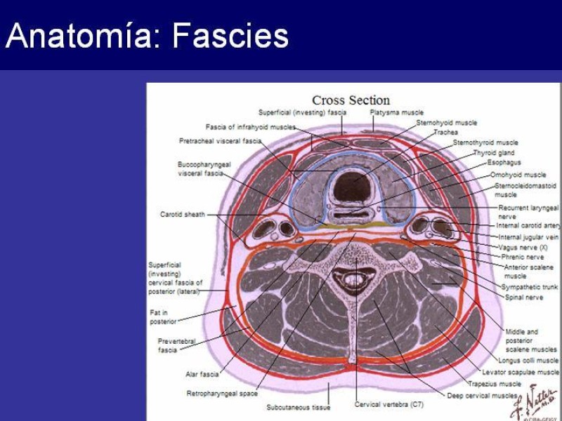 Diapositiva 14 de Trauma Cervical Penetrante