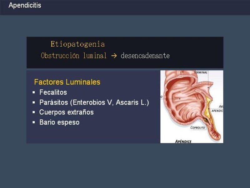 Diapositiva 4 de Apendicitis
