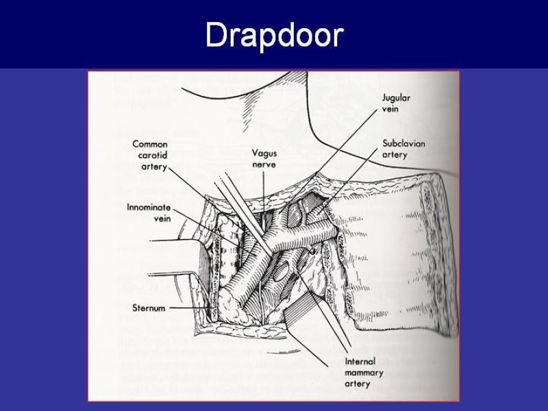 Diapositiva 47 de Trauma Cervical Penetrante
