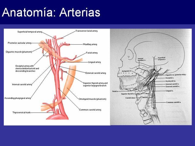 Diapositiva 9 de Trauma Cervical Penetrante