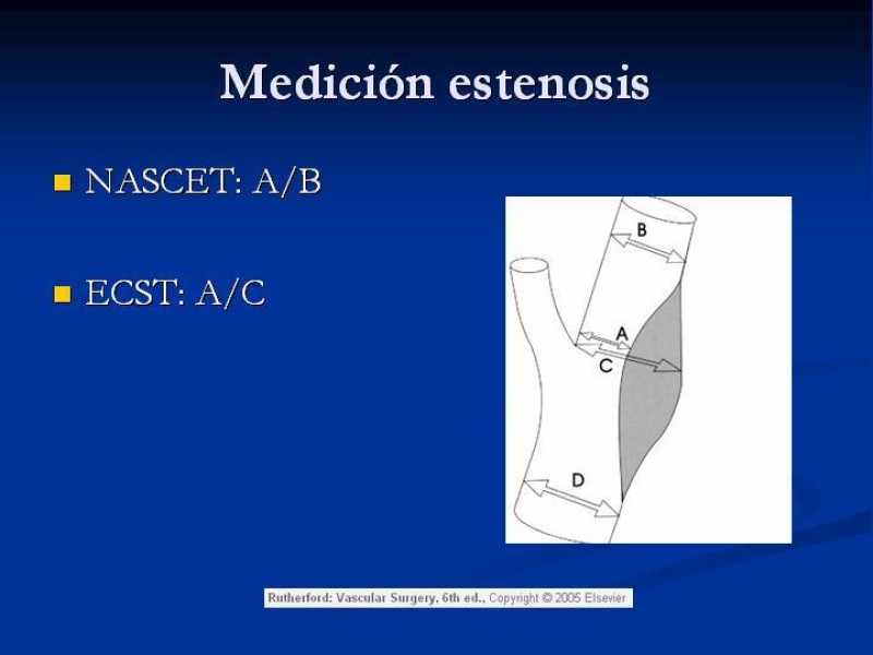 Diapositiva 10 de Estenosis Carotidea Endarterectomía y Angioplastía