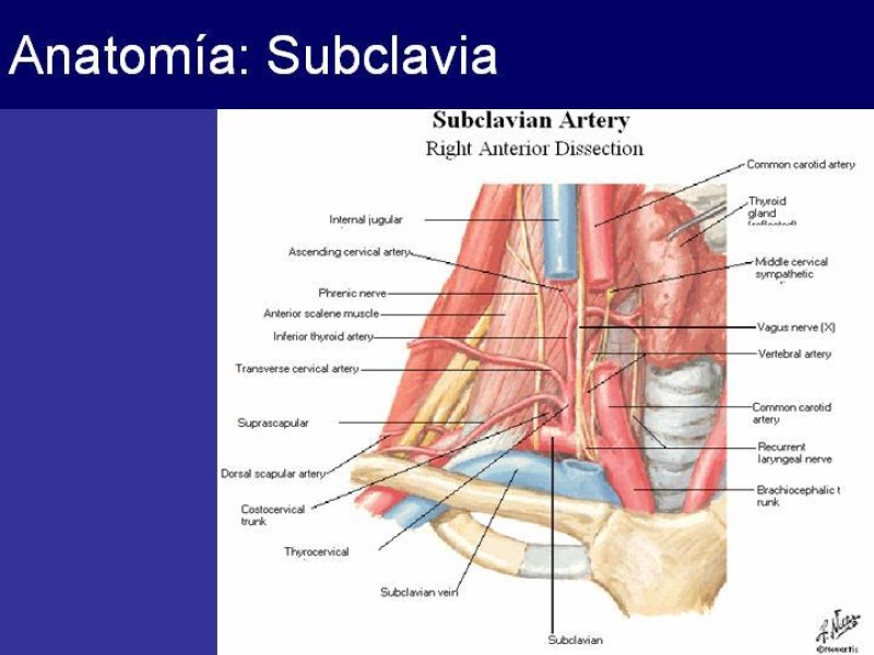 Diapositiva 12 de Trauma Cervical Penetrante