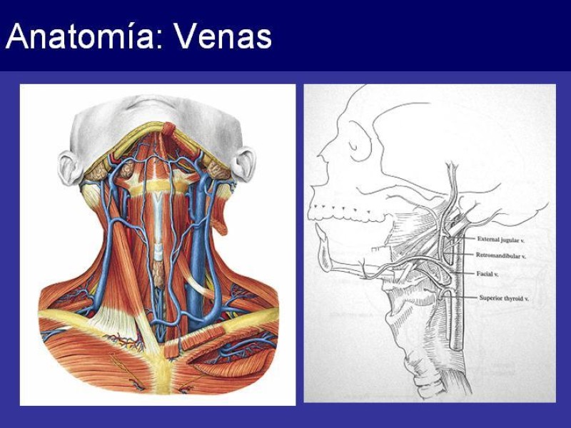 Diapositiva 7 de Trauma Cervical Penetrante