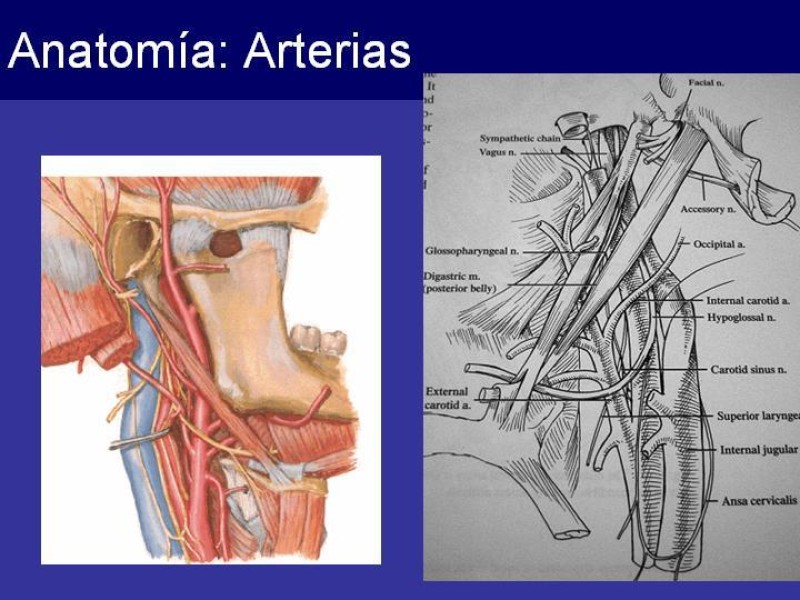 Diapositiva 11 de Trauma Cervical Penetrante