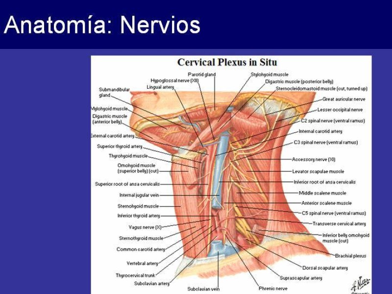 Diapositiva 13 de Trauma Cervical Penetrante
