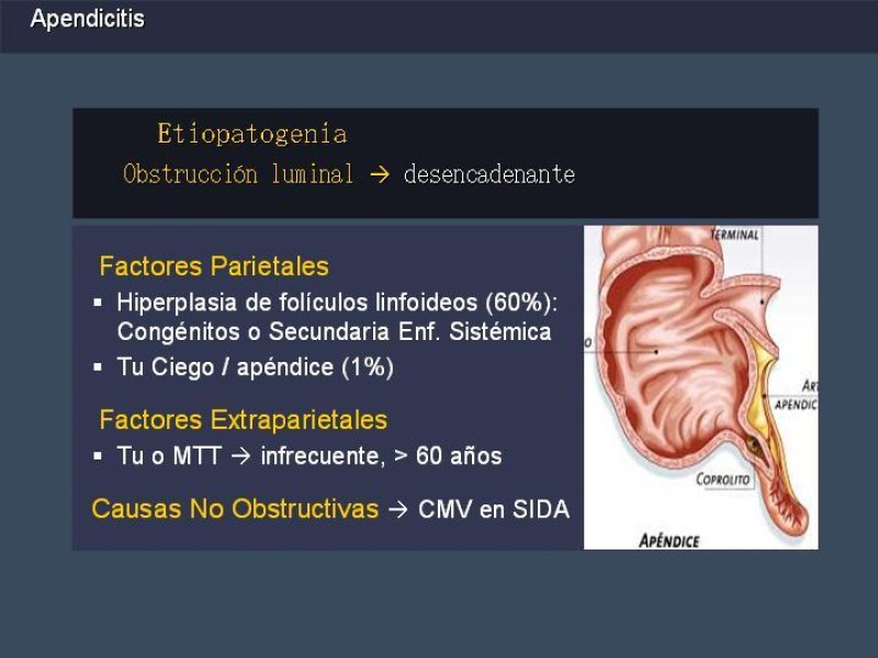 Diapositiva 5 de Apendicitis