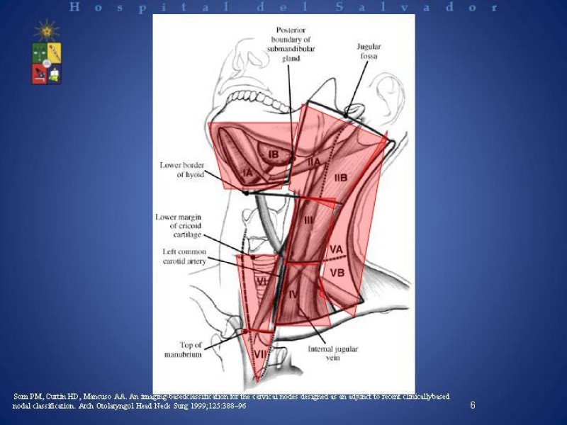 Diapositiva 5 de Metástasis Cervicales