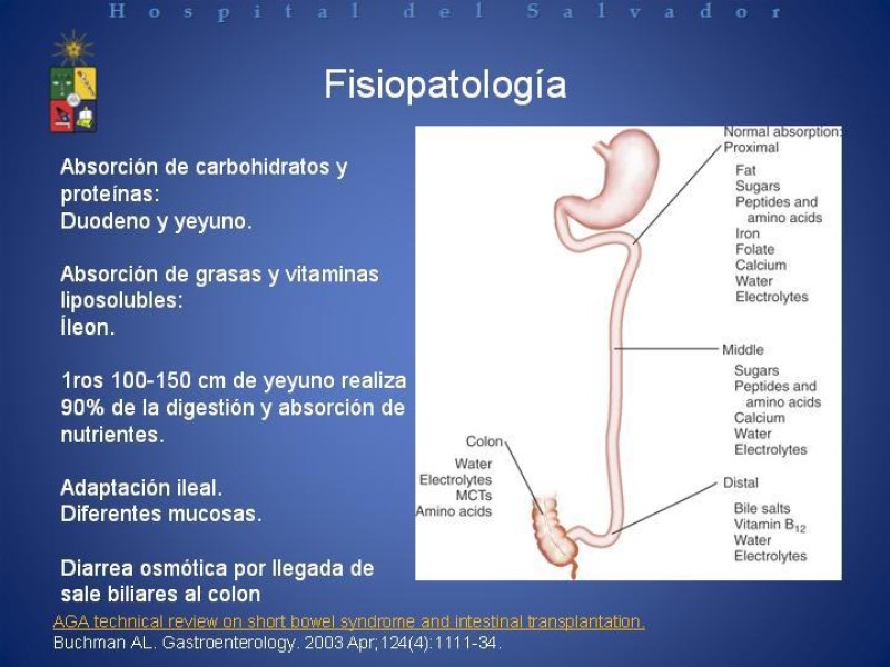 Diapositiva 6 de Síndrome de intestino corto